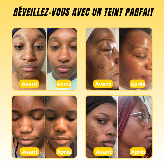 Masque de nuit au curcuma et à l’acide kojique