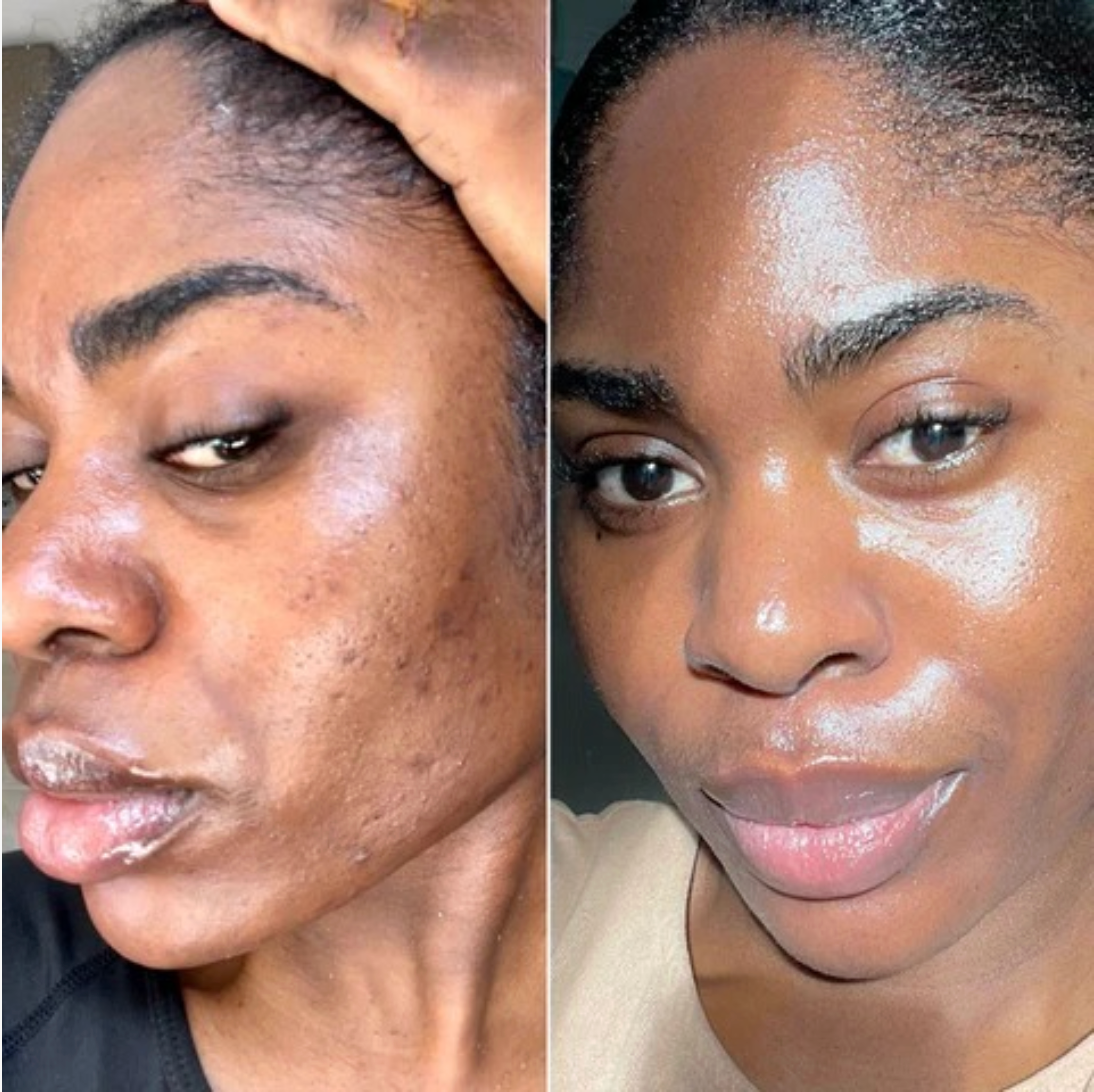 Masque de nuit au curcuma et à l’acide kojique