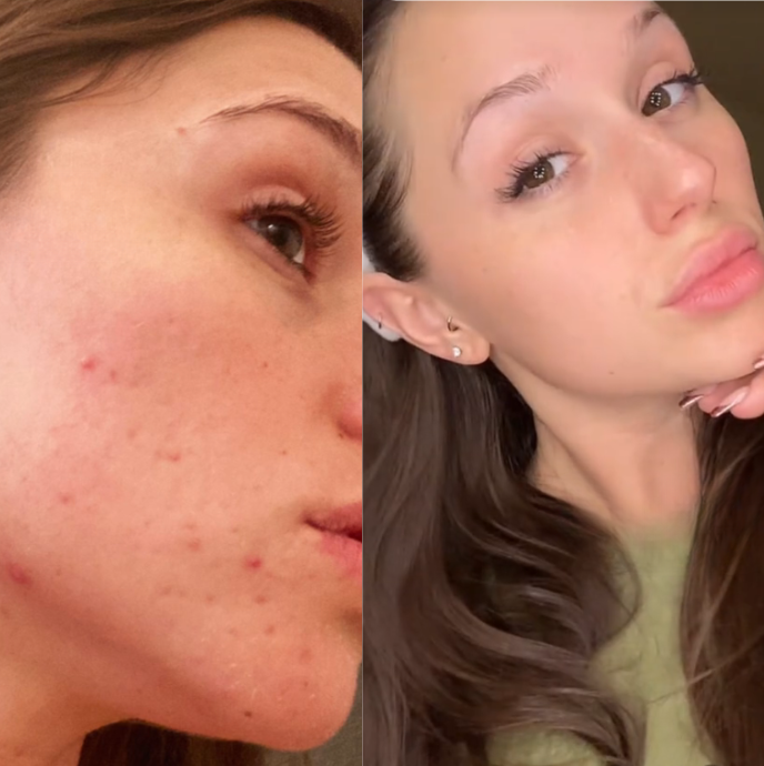 Masque de nuit au curcuma et à l’acide kojique